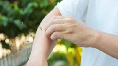 Aceite Esencial de Citronela como Repelente Natural de Mosquitos
